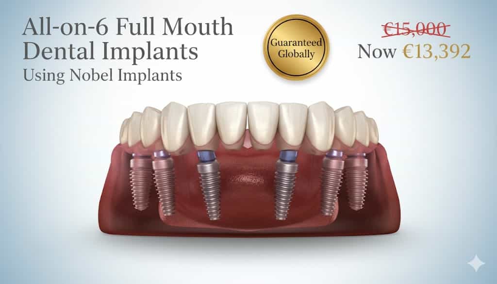 Premium All-on-6 Dental Implant Package - Nobel (Swiss Implant)