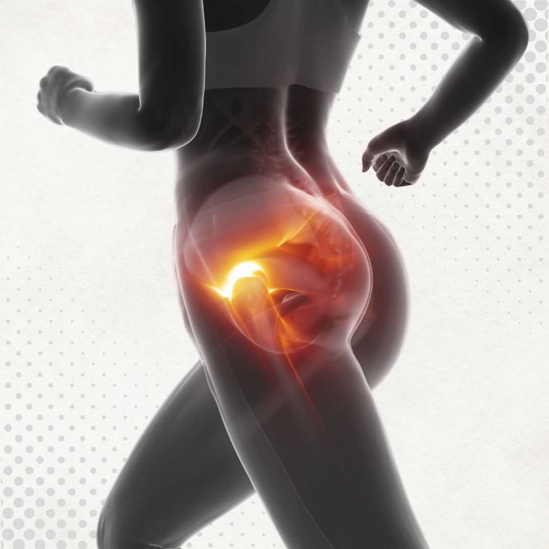 Stem Cell Therapy for Hip Osteoarthritis Package in San Jose del Cabo, Mexico by Longevity Medical Institute®