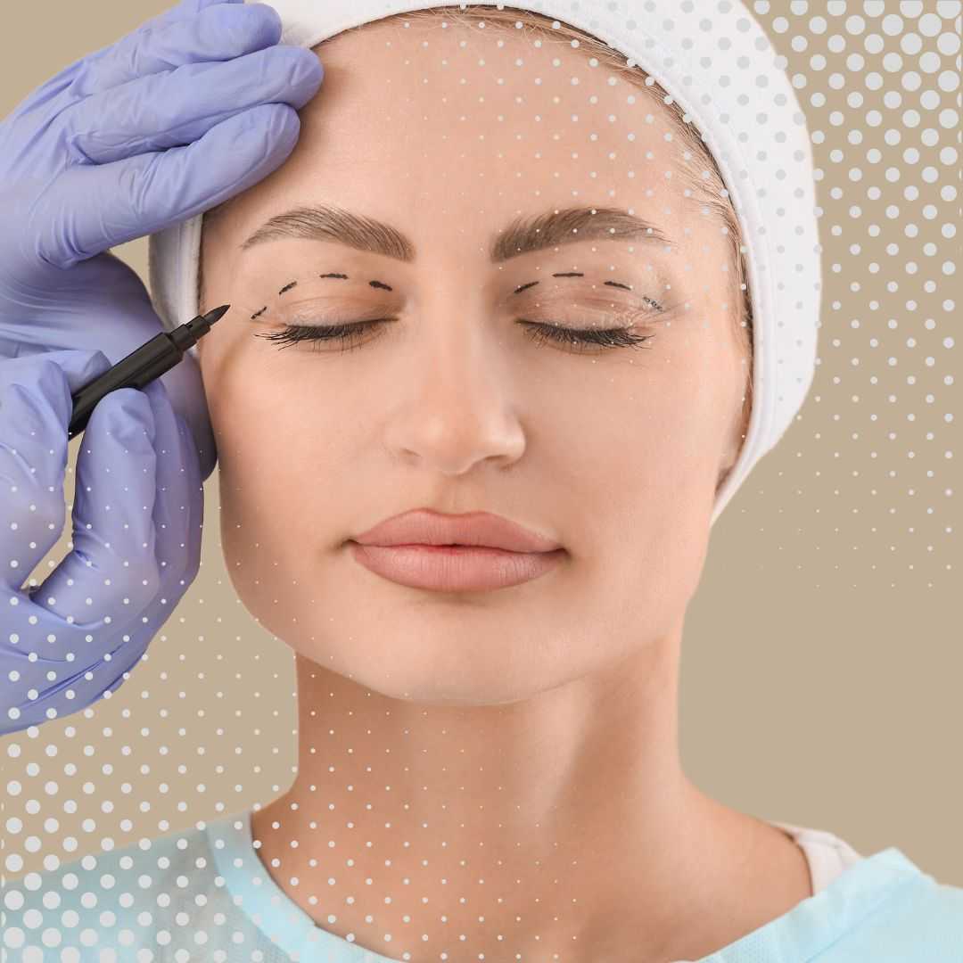 Eyelid Surgery Package in Yerevan, Armenia by Boroyan Plastic Surgery