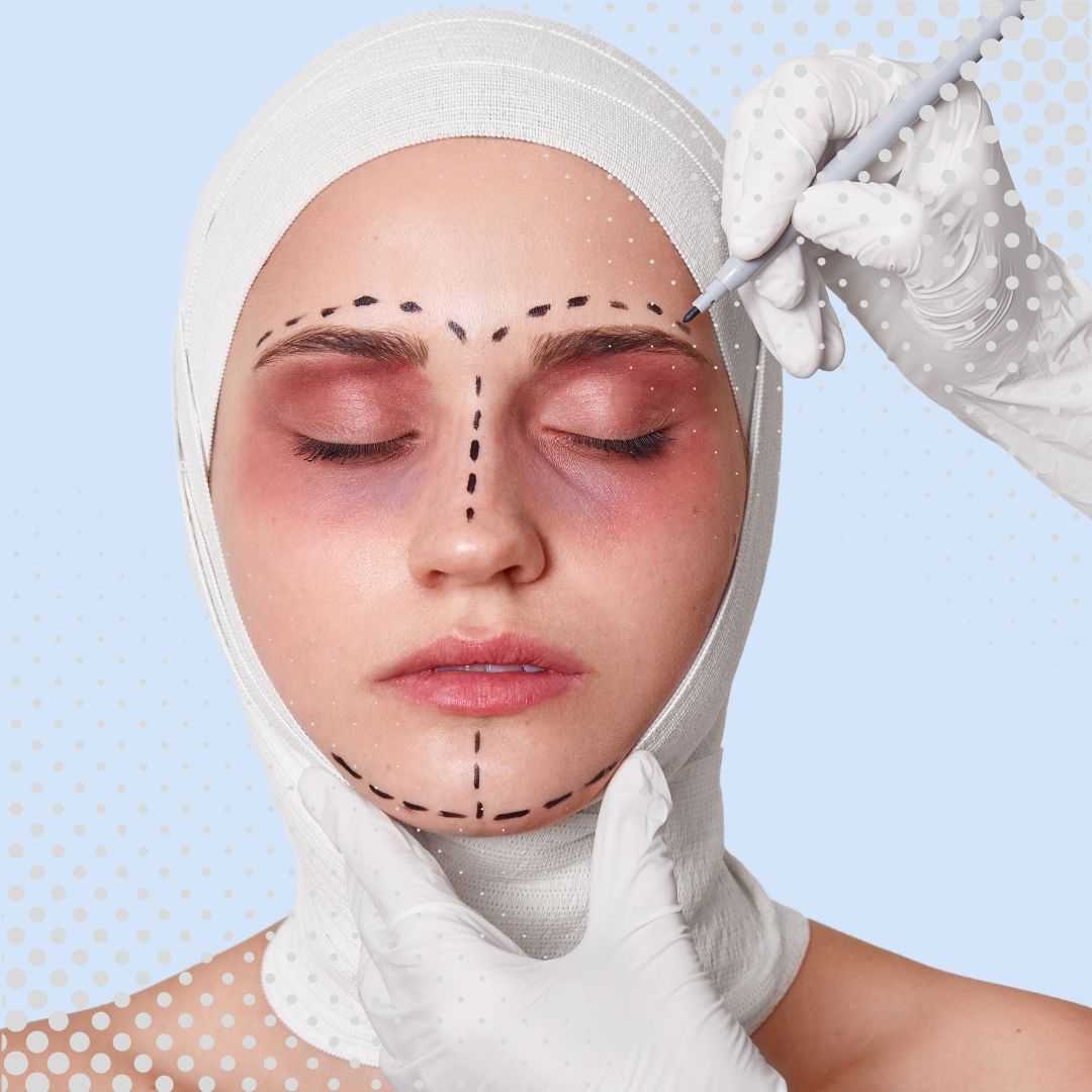 Brow Lift Package in Yerevan, Armenia by Boroyan Plastic Surgery