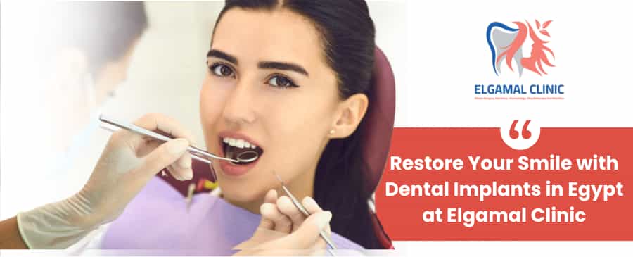 Dental Implants Package by Elgamal Clinic