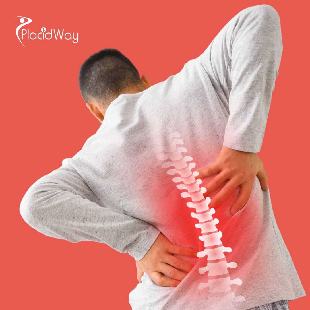 Advanced Degenerative Disc Treatment with Bangkok Stem Cell Package by Vega Clinic