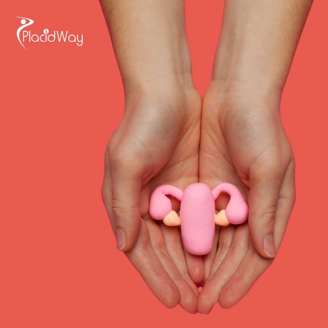 Alternative Ovarian Cancer Treatment Package in Tijuana, Mexico by ITC