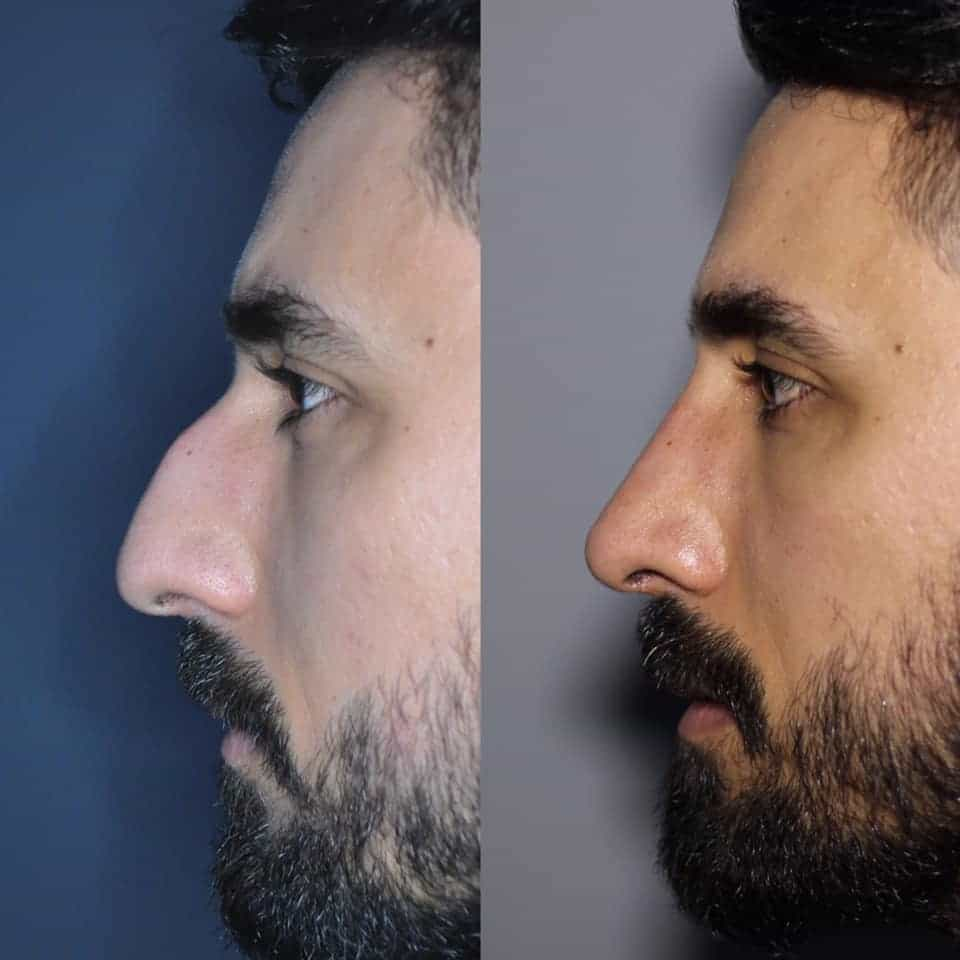 Istanbul Rhinoplasty Center / Assoc. Prof. Dr. Mehmet Emre Dinc