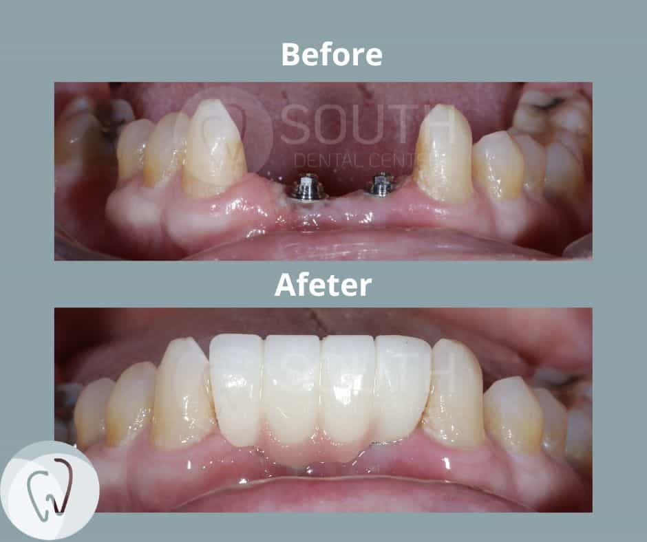 South Dental Center