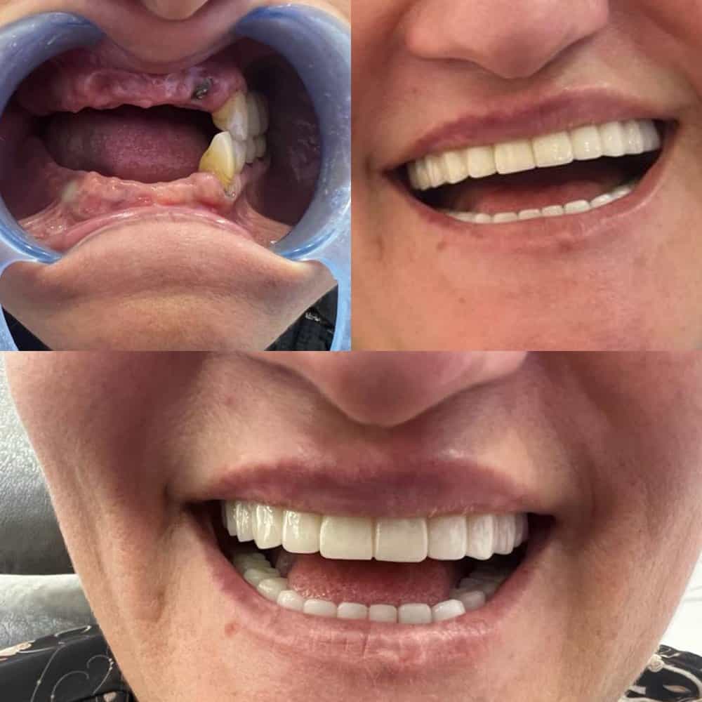 Zirve Dental