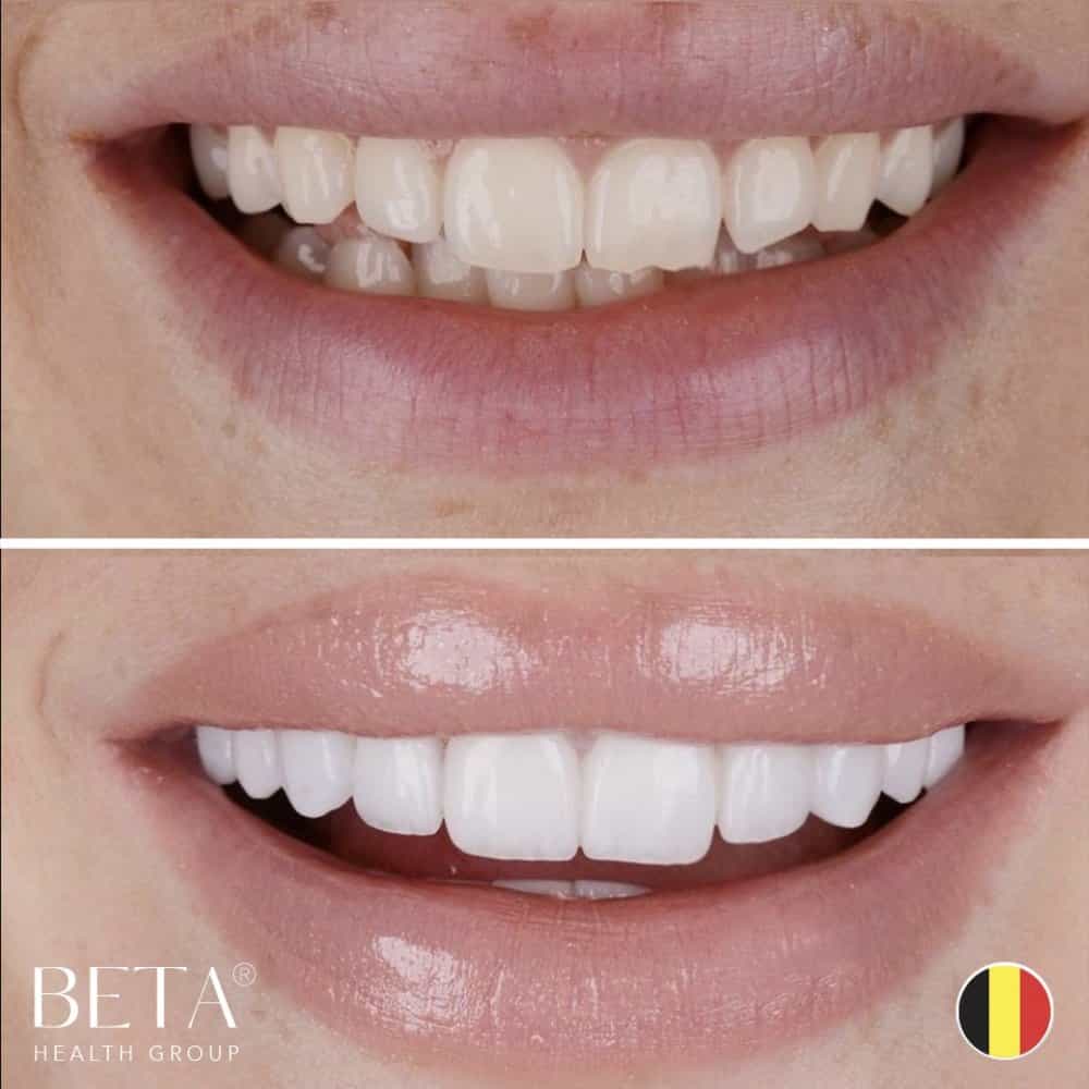 Beta Health Group