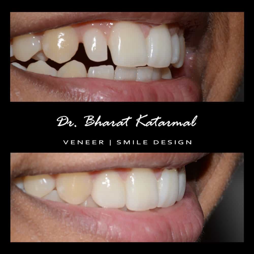 Dr. Bharat Katarmal Dental and Implant Clinic