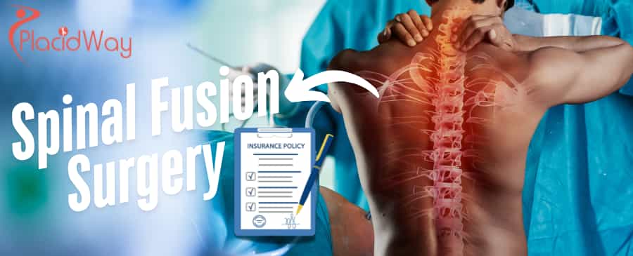 Spinal Fusion Surgery Cost Without Insurance