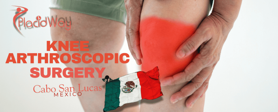 What is the Average Cost of Knee Arthroscopic Surgery in Cabo San Lucas, Mexico?