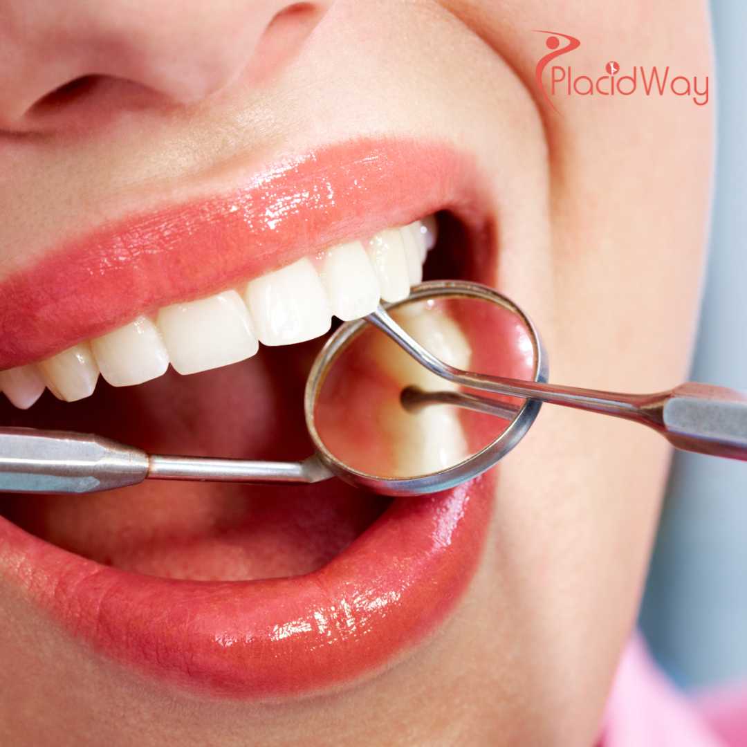 What are the Top Dental Treatments You Can Expect During a Vietnam Dental Tour?