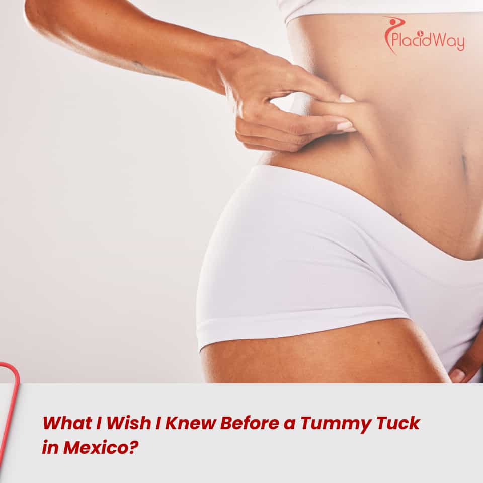 What I Wish I Knew Before a Tummy Tuck in Mexico?