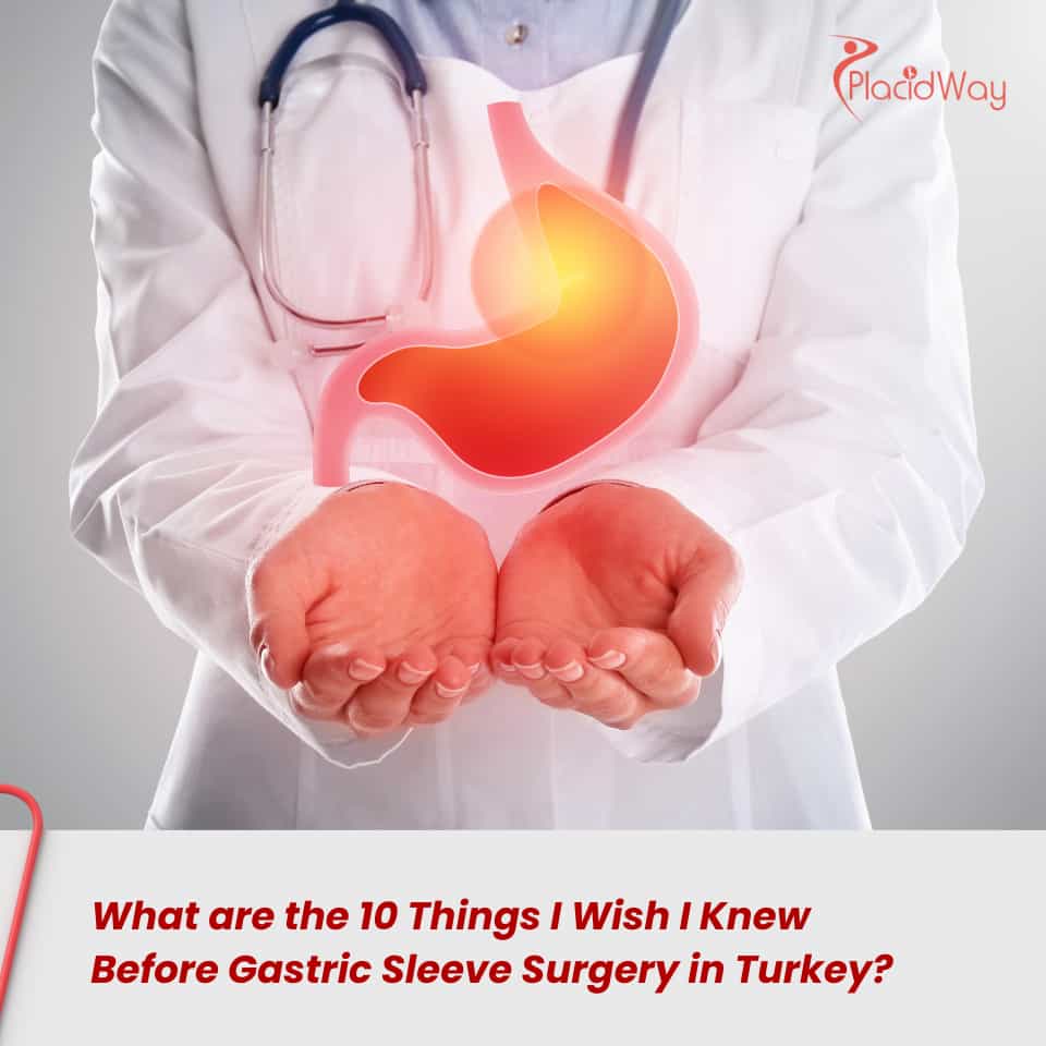 What are the 10 Things I Wish I Knew Before Gastric Sleeve Surgery in Turkey?