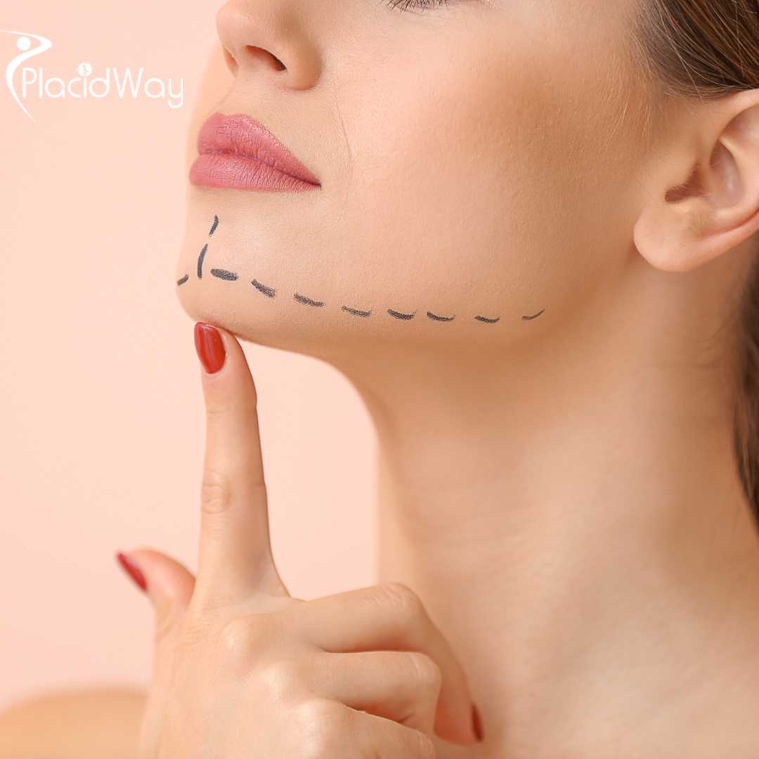Why is Medical Tourism in Mexico Popular for Plastic Surgery Procedures?