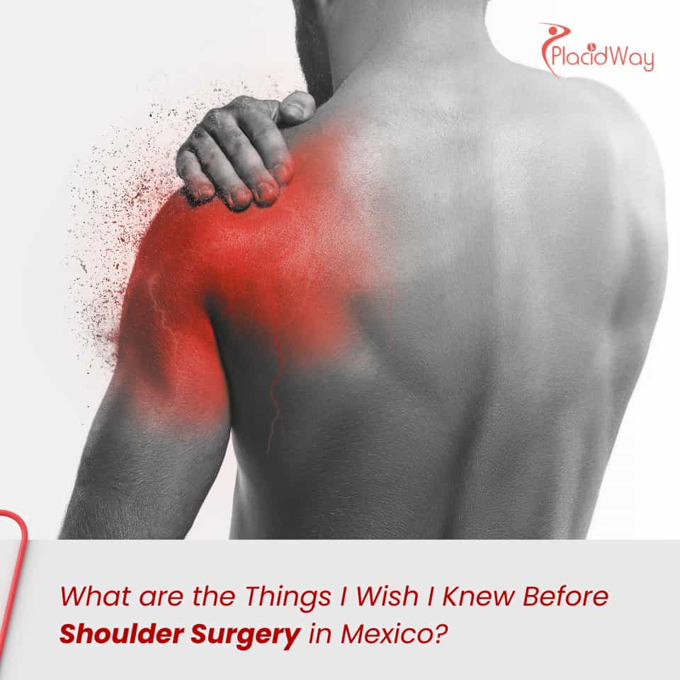 What are the Things I Wish I Knew Before Shoulder Surgery in Mexico?