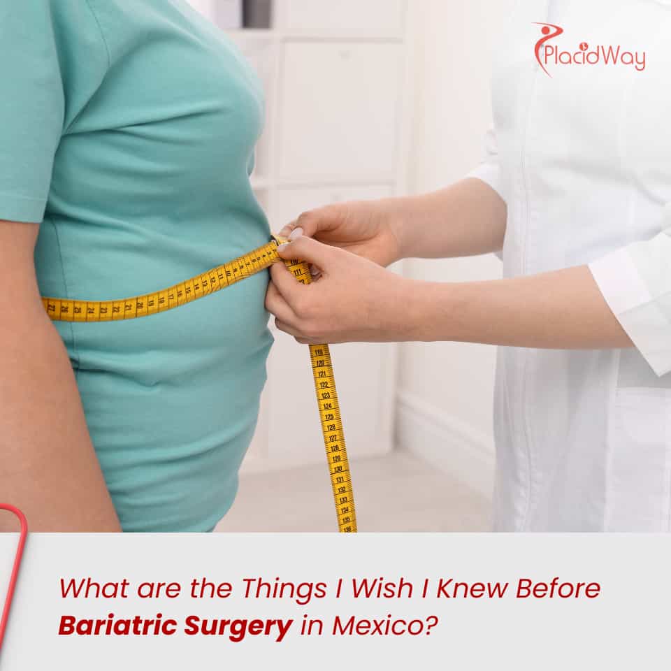 What are the Things I Wish I Knew Before Bariatric Surgery in Mexico?