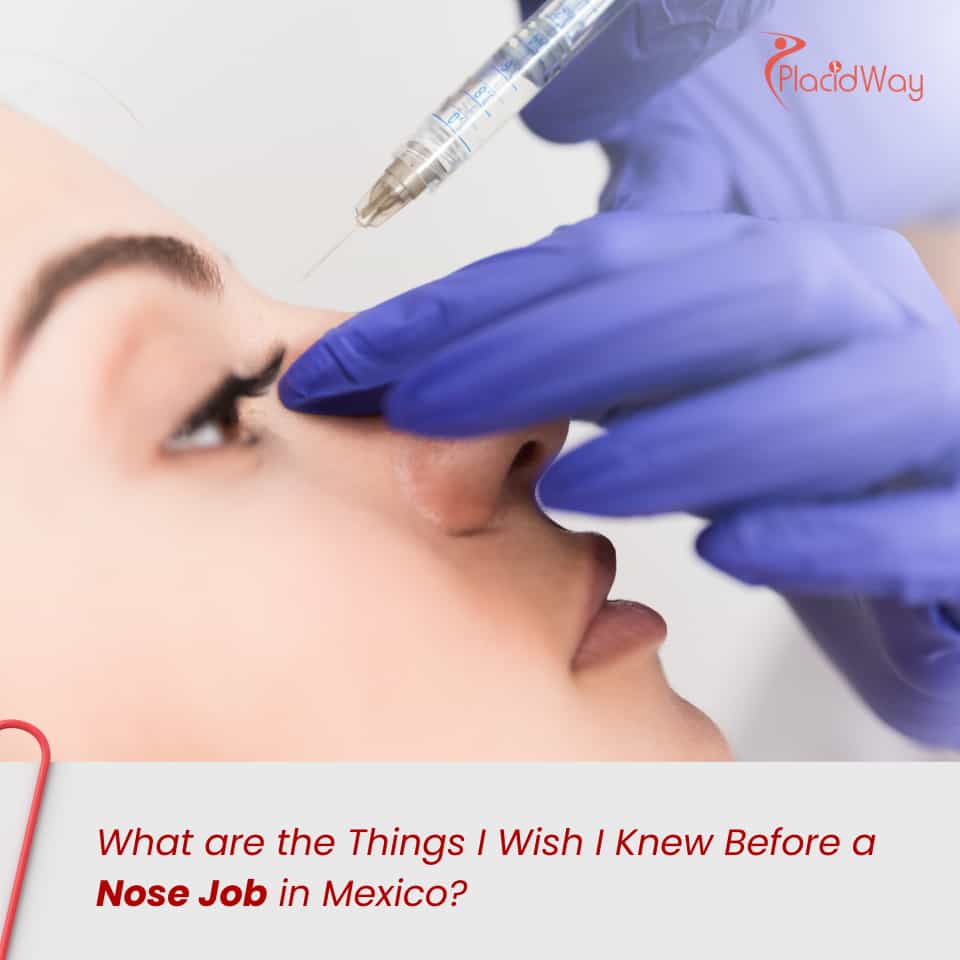 What are the Things I Wish I Knew Before a Nose Job in Mexico?