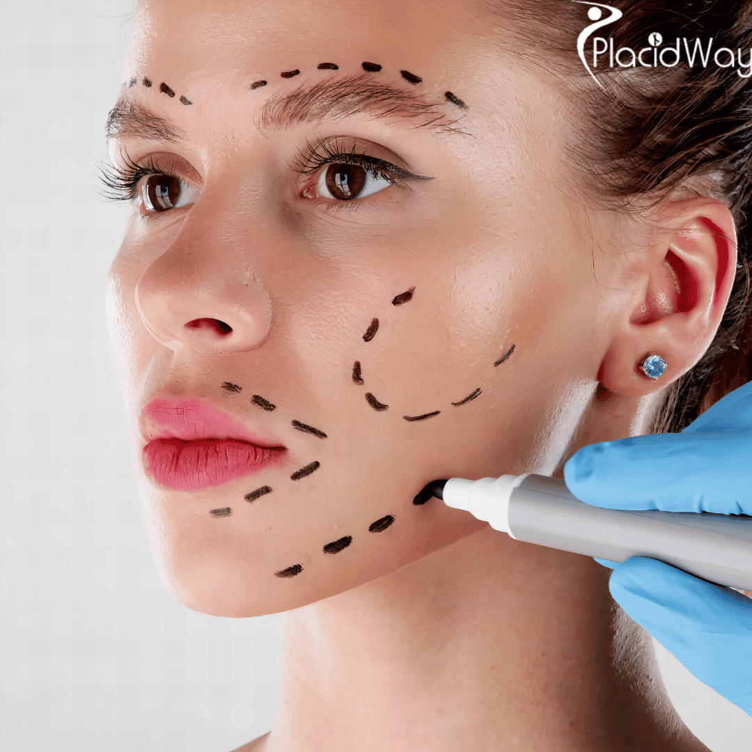 Why is Medical Tourism the Best Option for a Deep Plane Facelift?