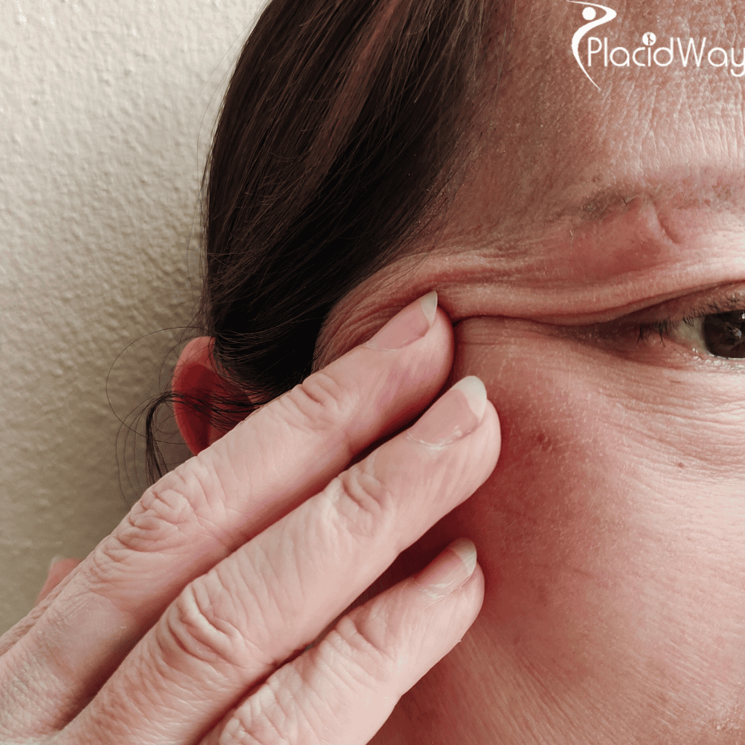 How Can Oculoplastic Surgeons in Mexico Offer Affordable, High-Quality Eye Treatments?