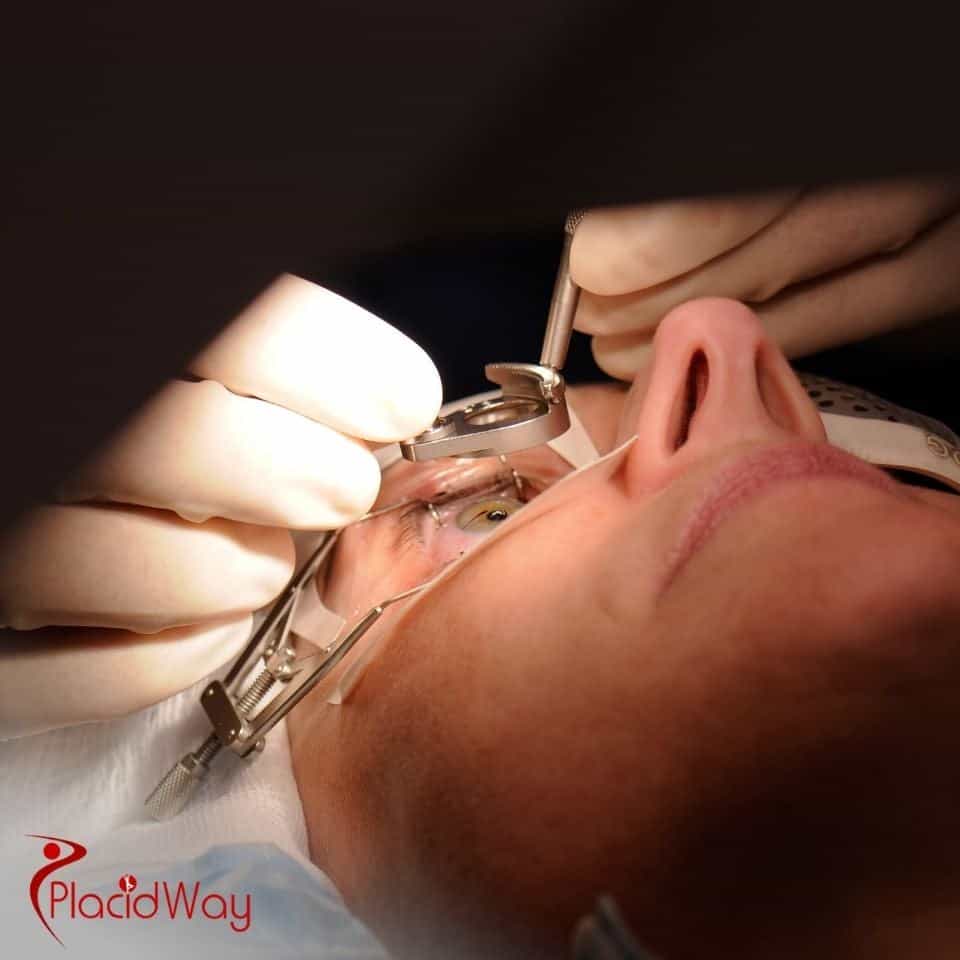 How much does eye surgery cost in Tijuana?