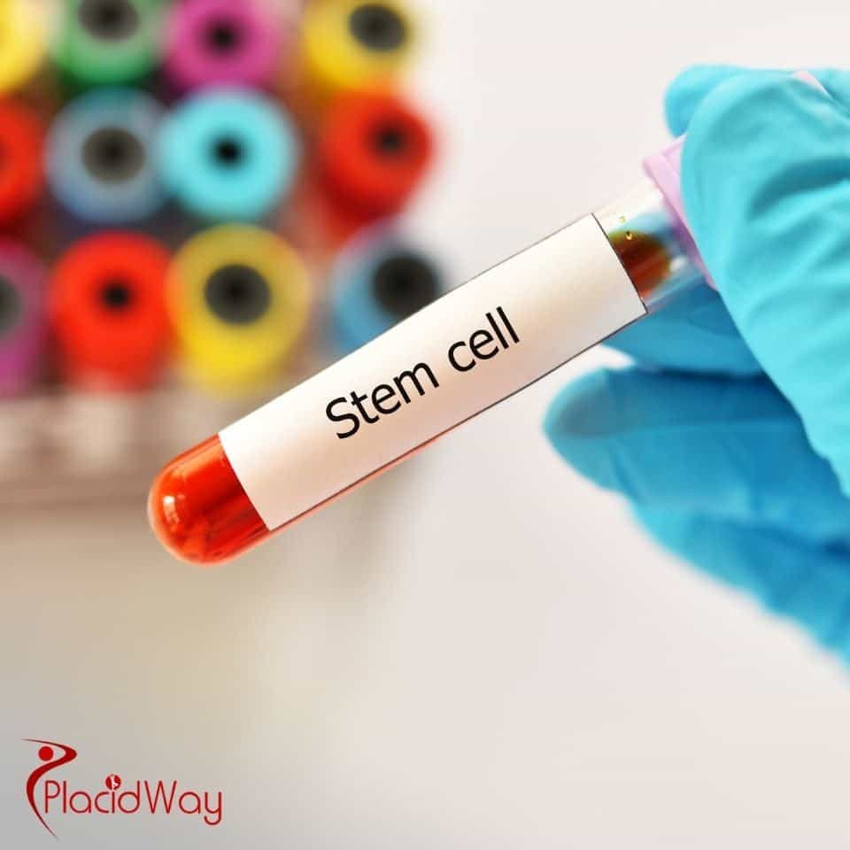 Which country offers the cheapest stem cell treatment?