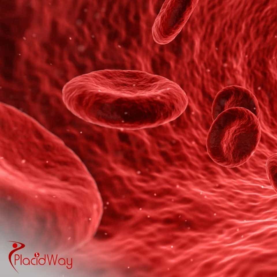 What is the best stem cell treatment in the world?