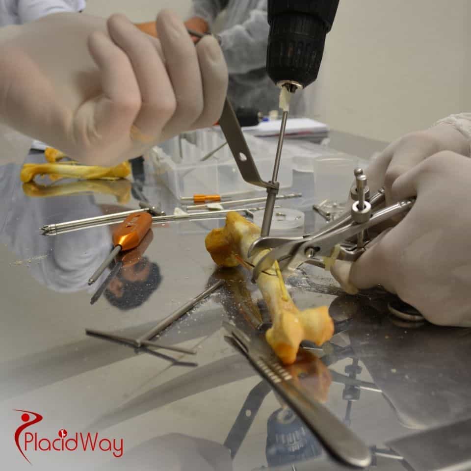 How much does orthopedic surgery cost without insurance?