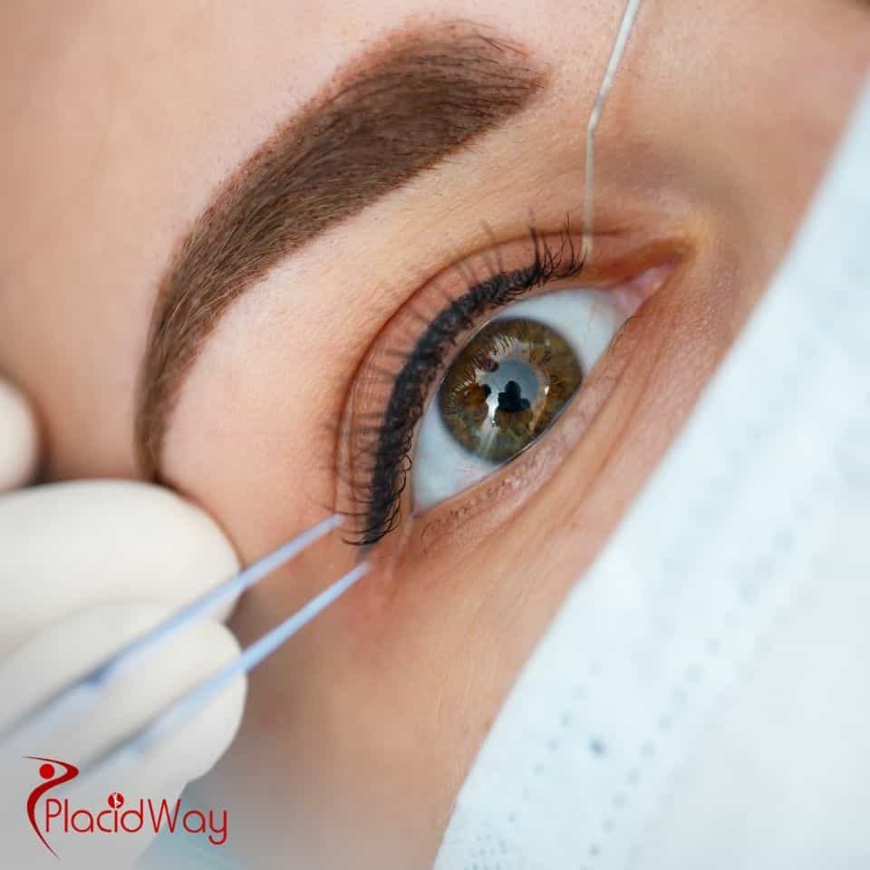 Is affordable laser eye surgery available in Mexico?