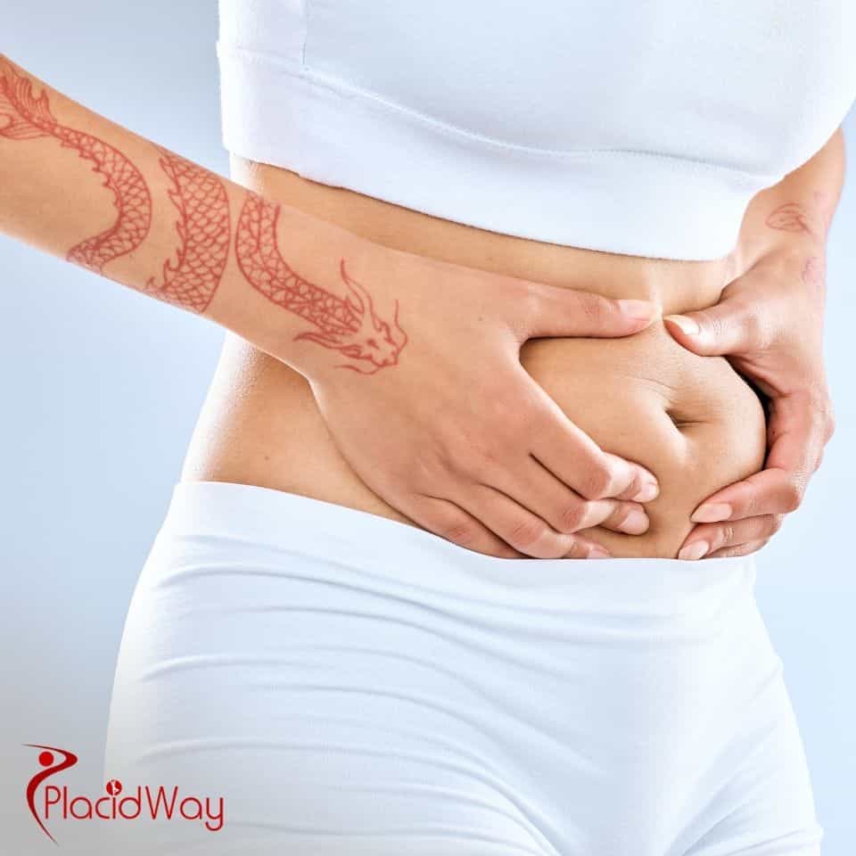 What are the Mexico tummy tuck package options?