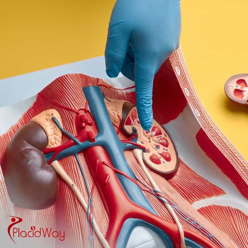 Where can patients get kidney stone surgery in Tijuana?