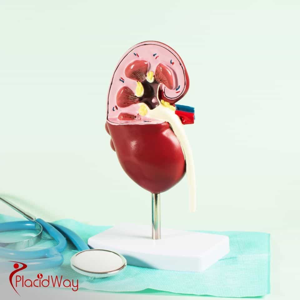 What is the average price of a lithotripsy procedure?