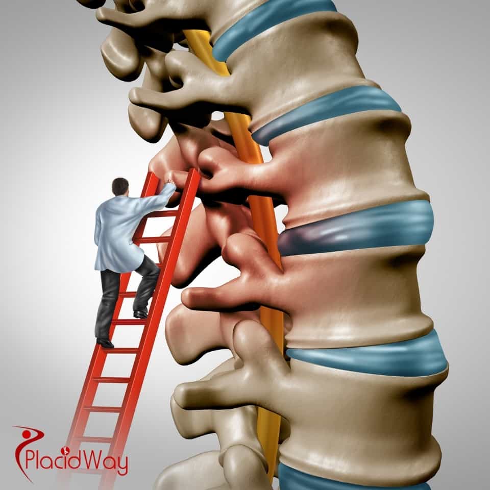 Which are the best spine surgery hospitals in the world?