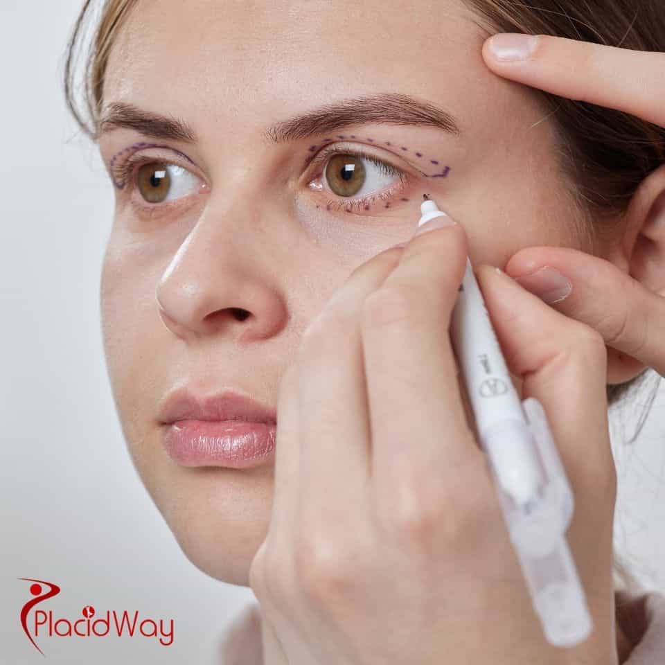 What is the price of blepharoplasty in Tijuana?