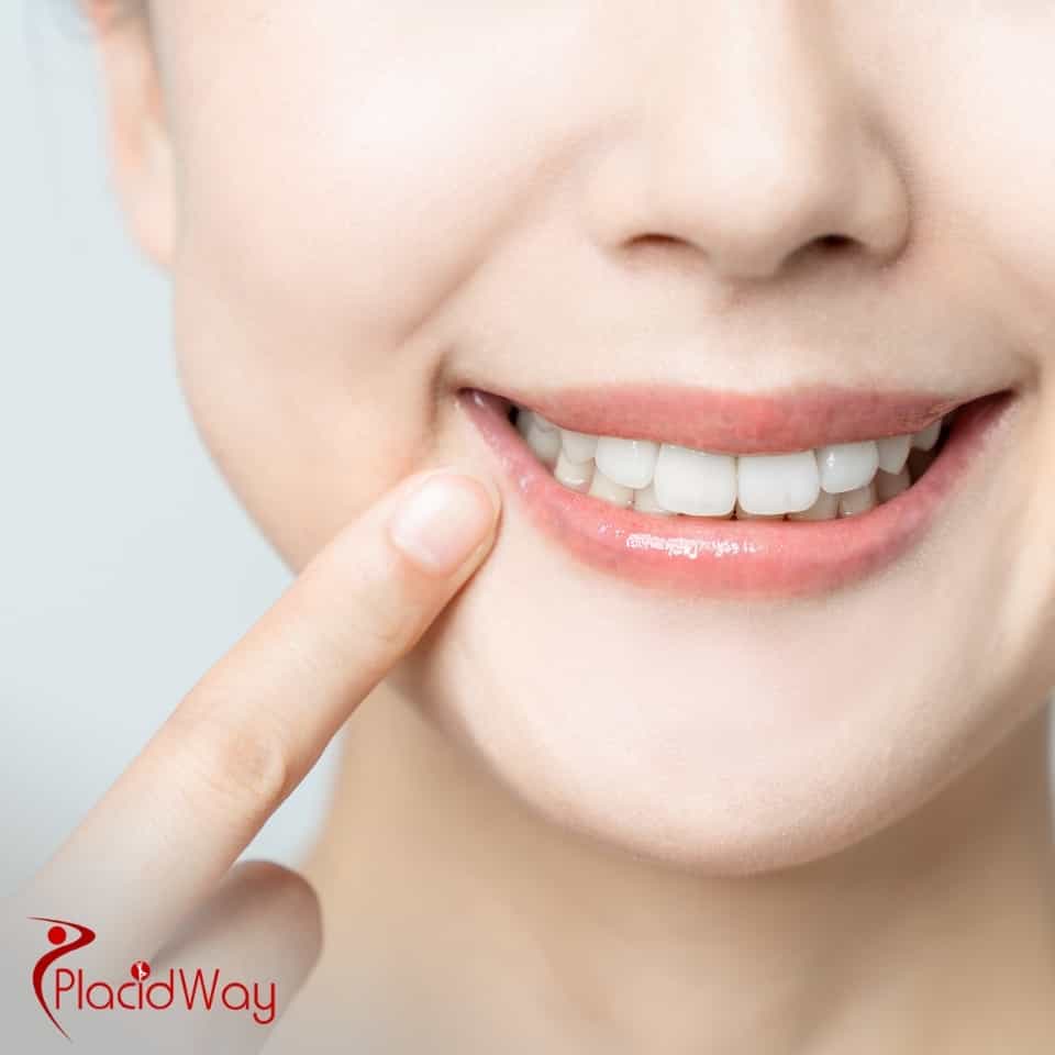 How Much Does Full Mouth Dental Implants Cost In The Dominican Republic?