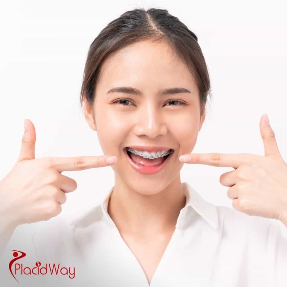 What Is The Average Cost For Braces In Mexico?