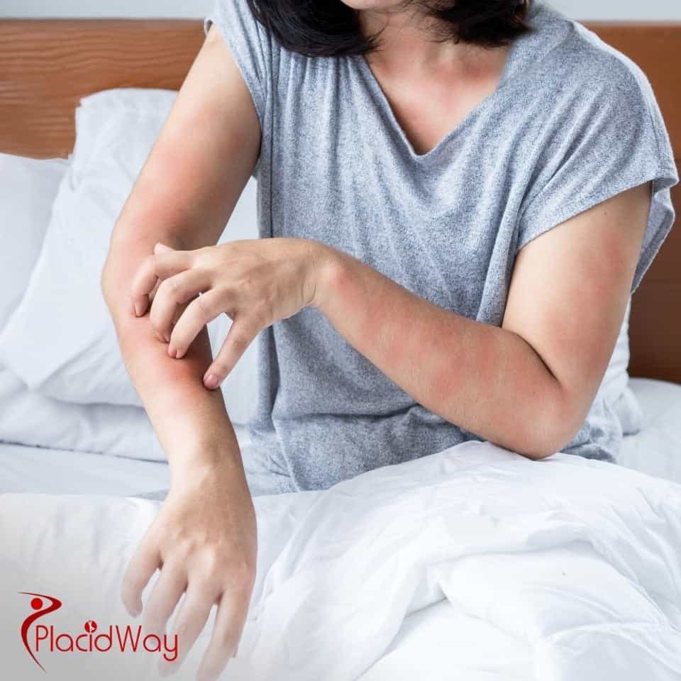 What Is The Cost Of Stem Cell Therapy For Lyme Disease?