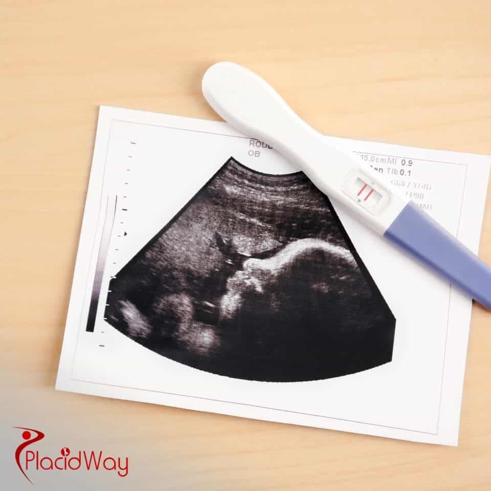 Is Egg Donation Available In The UAE And How Is It Regulated?