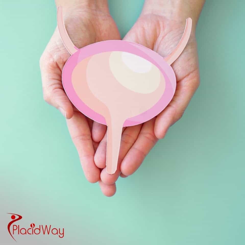 What Are The Best Options For Bladder Cancer Treatment In Mexico?