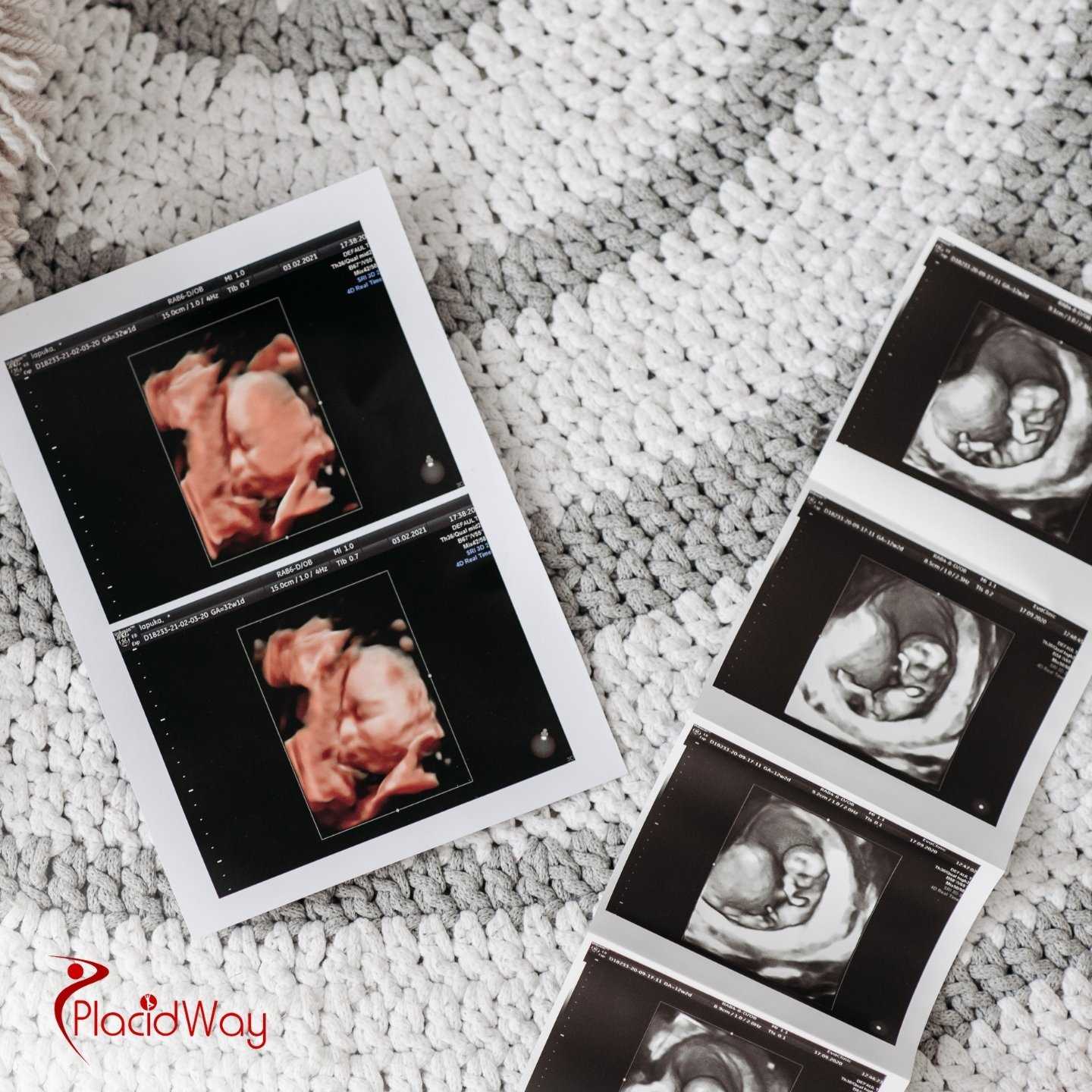 Which Country Is Considered The Best Choice For IVF Treatment Abroad?