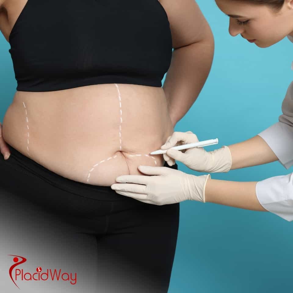 Who Are The Top 10 Bariatric Surgeons In The World?