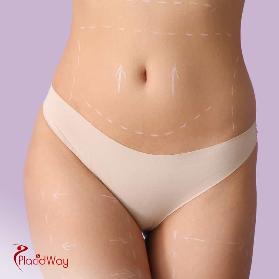 How Much Does Abdominoplasty Cost In Mexico?