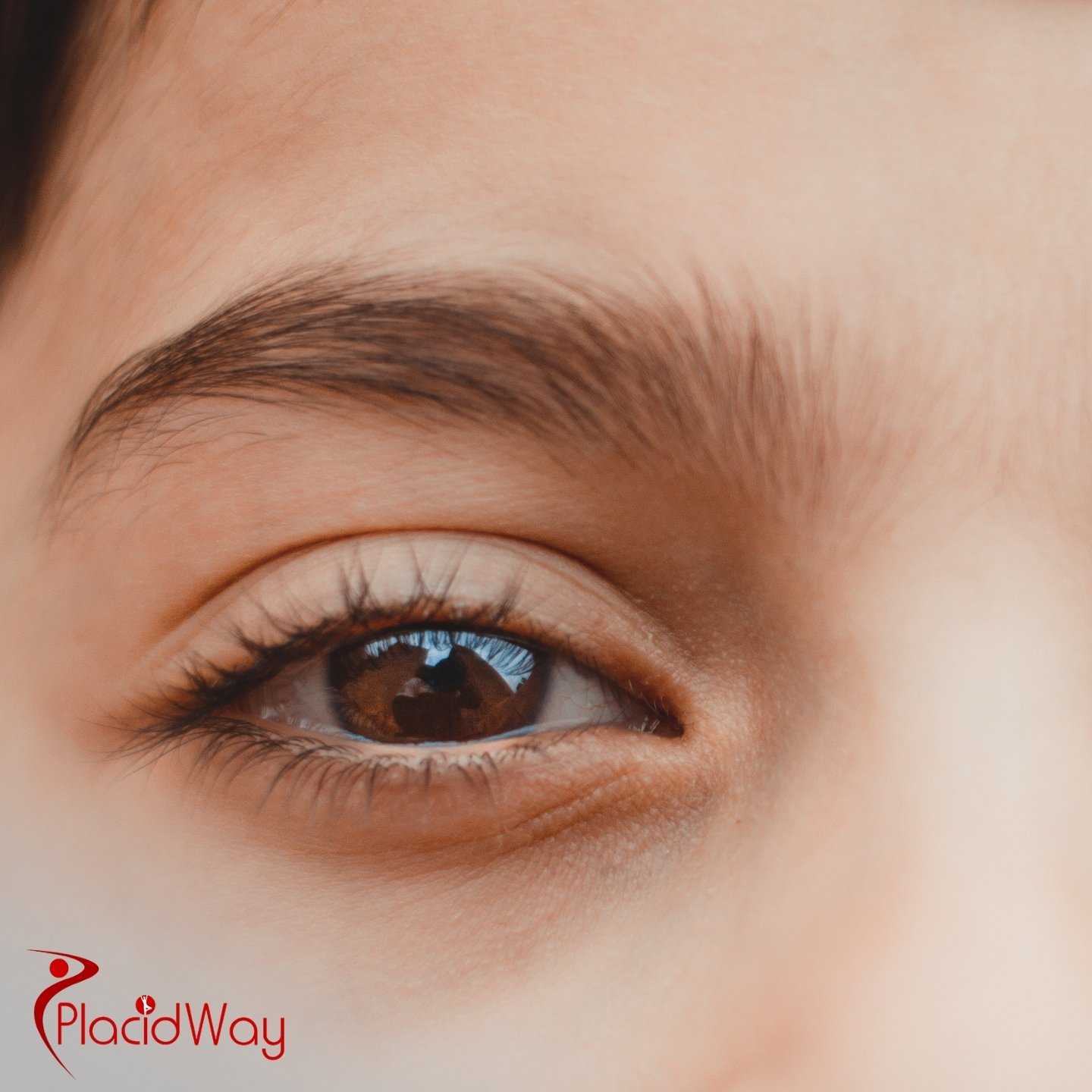 What Is The Price Of Lazy Eye Surgery?