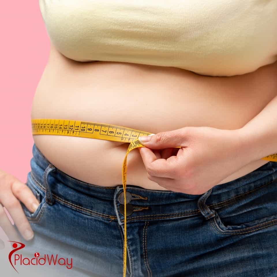 What Are The Reviews For Mexico Bariatric Centers?