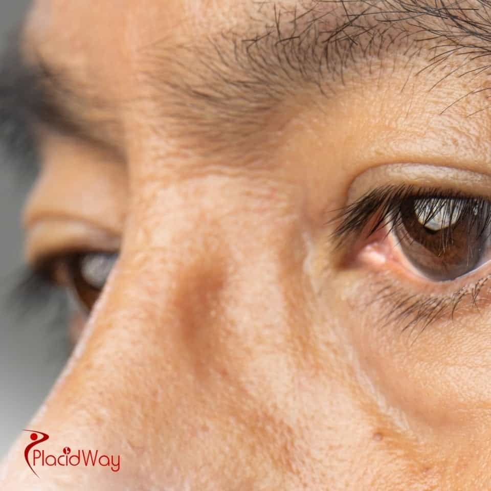 Where Is Laser Cataract Surgery Available In Tijuana?
