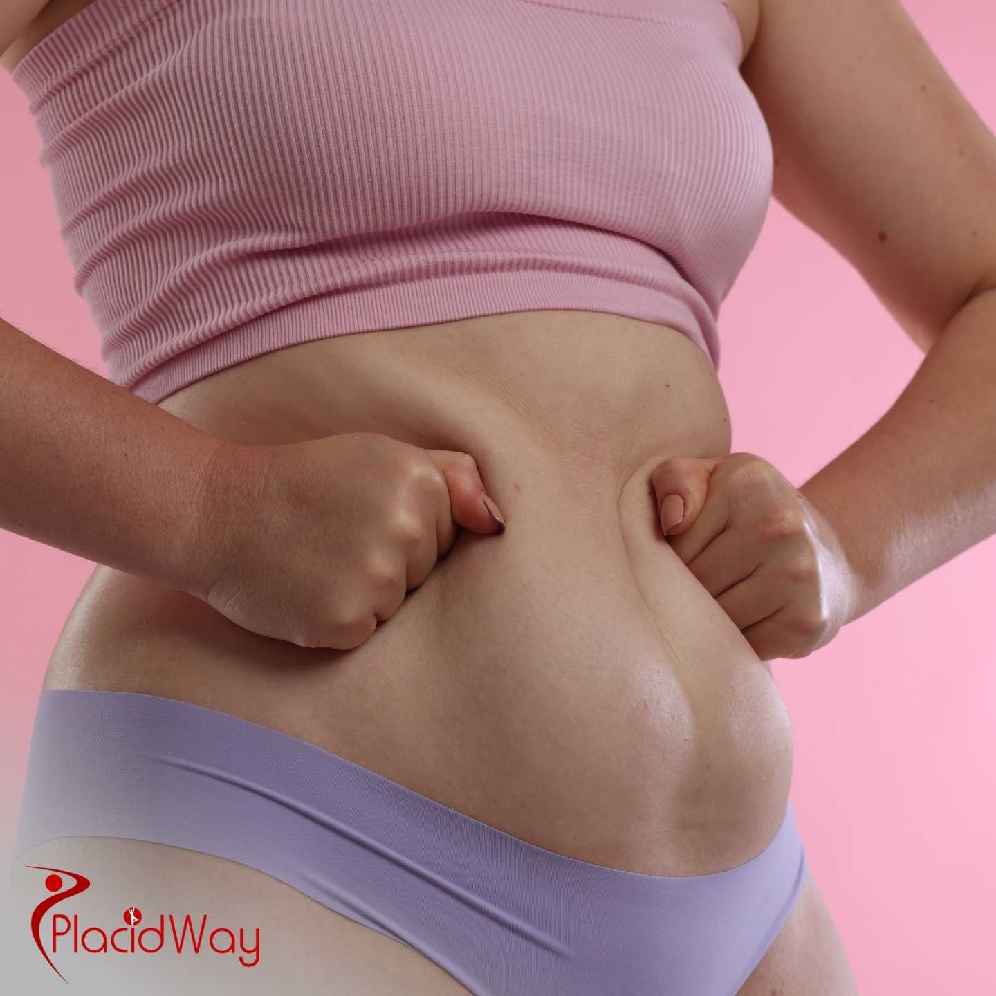 Where Can I Undergo Liposuction In Puerto Vallarta?