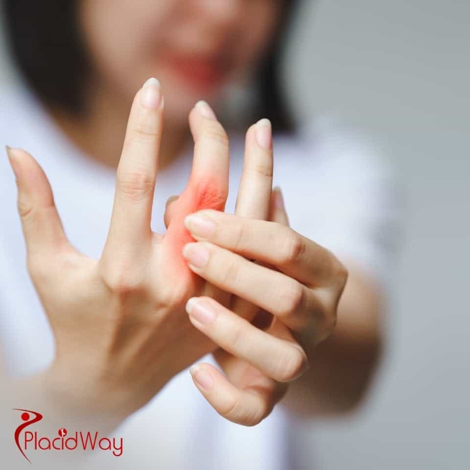 How Much Does Stem Cell Therapy for Rheumatoid Arthritis Cost?