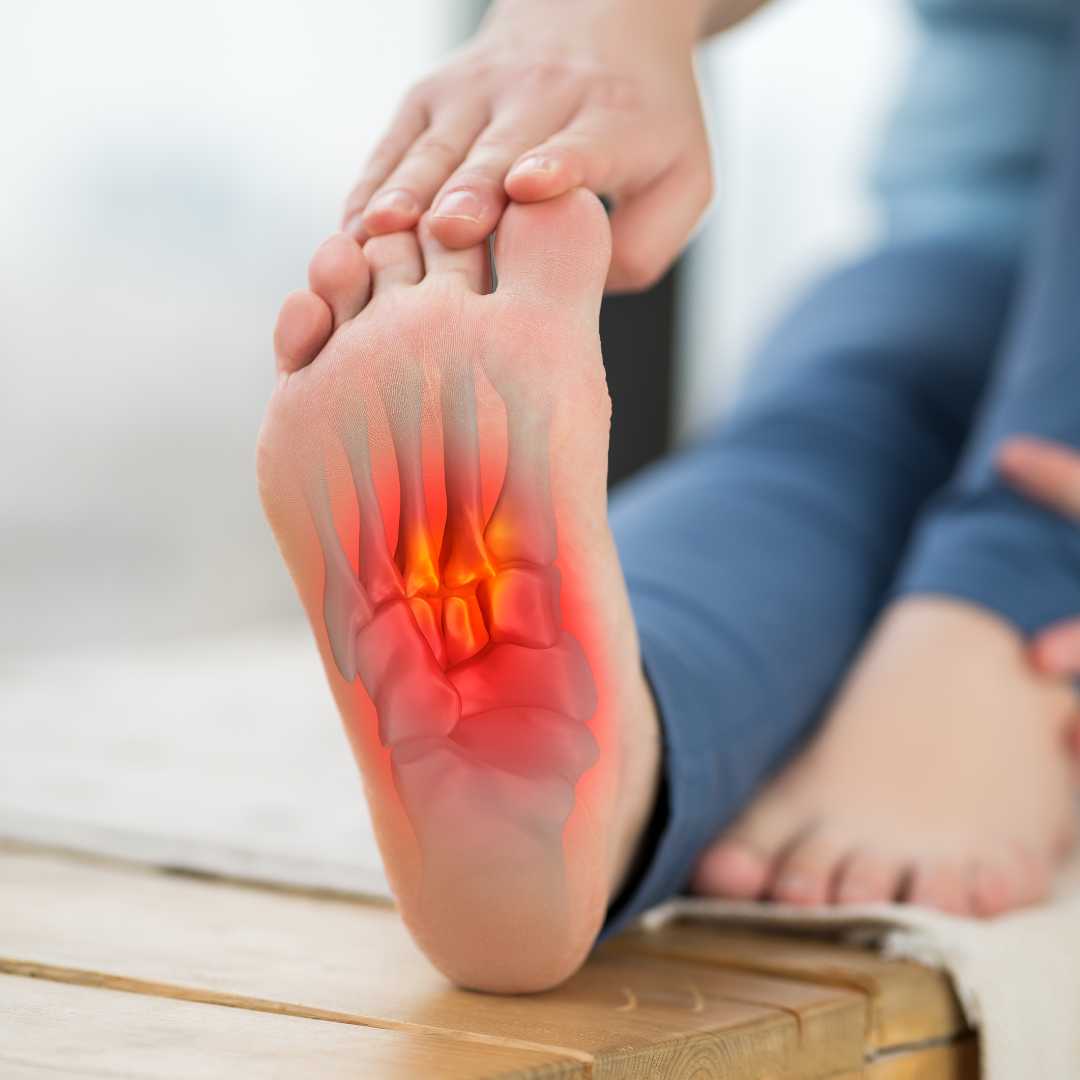What Finally Cured my Plantar Fasciitis?