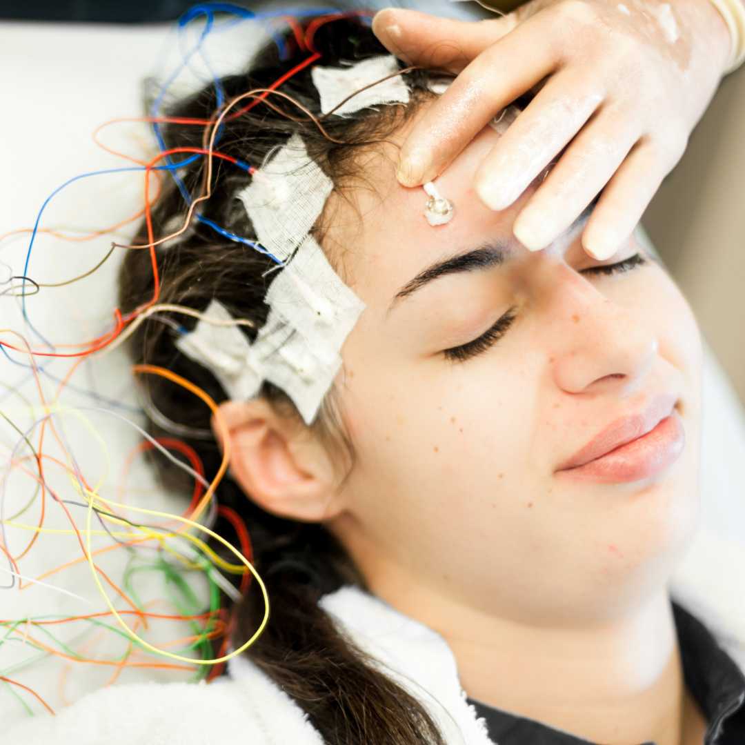 How Much Does Stem Cell Therapy for Epilepsy Cost?