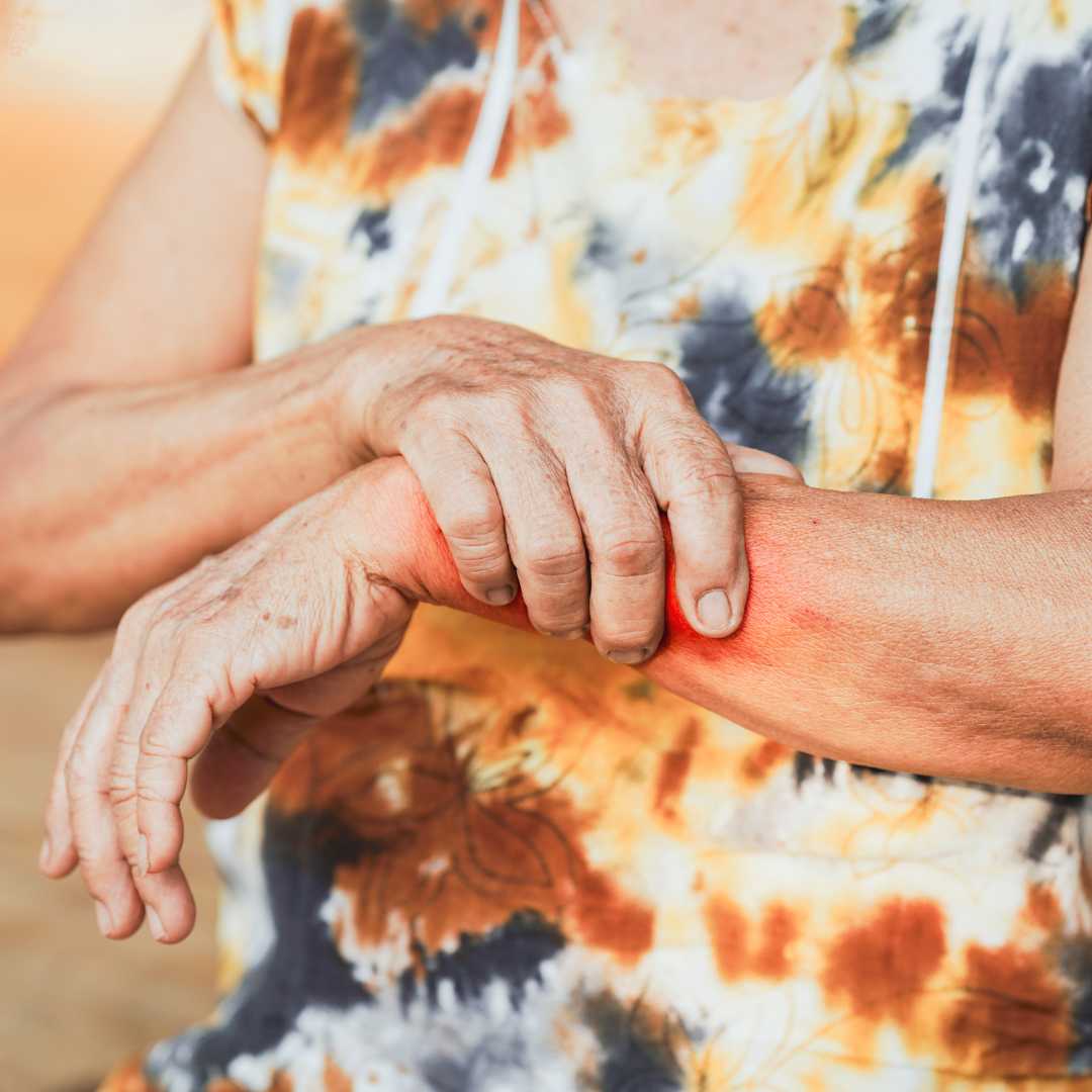 Can Lupus be Cured with Stem Cells?