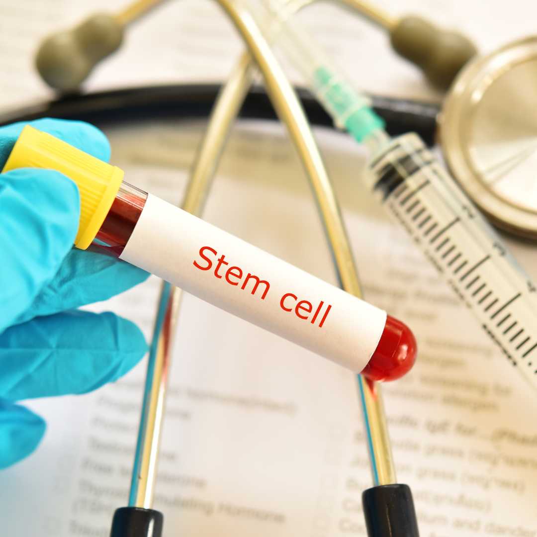 Does Mexico Allow Stem Cell Therapy?